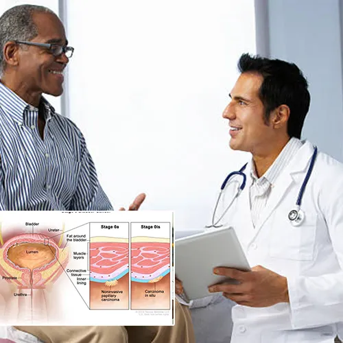 Welcome to  Urological Consultants of Florida 
: Pioneers in Penile Implant Innovations