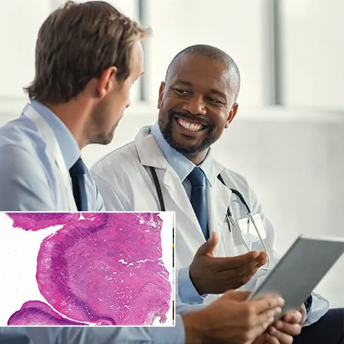 Connect with  Urological Consultants of Florida 
for Your Penile Implant Needs
