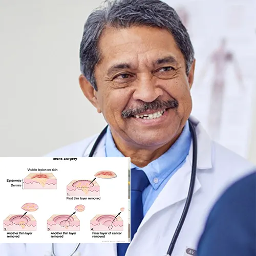What Sets Urological Consultants of Florida 
 Apart in Penile Implant Surgery