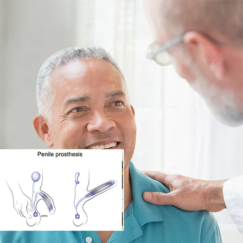 Penile Implants: The Surgical Solution for Lasting Satisfaction